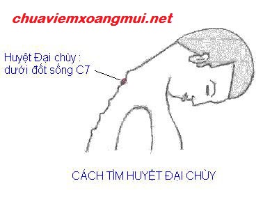 cach-chua-viem-mui-di-ung-bang-bam-huyet (4)