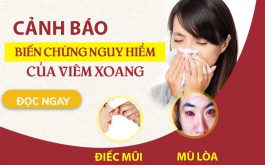 NGUY HIỂM: Dấu hiệu viêm xoang mũi nếu không được giải quyết sớm có thể dẫn đến “ĐIẾC MŨI” giảm thị lực